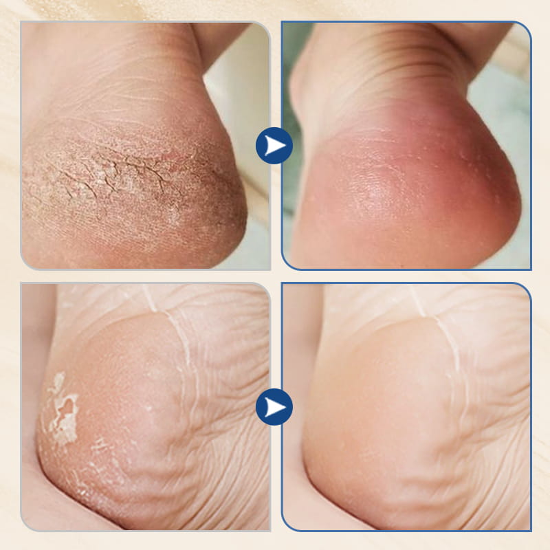 Hydrating and Anti-Cracking Foot Cream-Autumn/Winter Essential