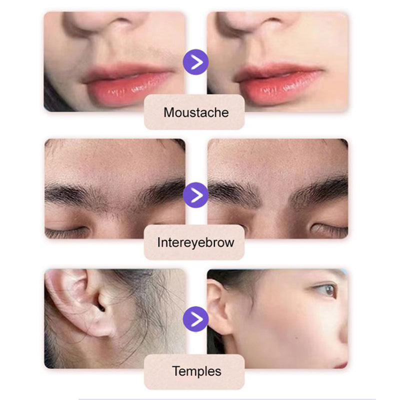 💗Last Day Special Price £4.49 ! 🔥Buy 3 Get 5 Free🔥Gentle and Painless Facial Hair Removal Cream