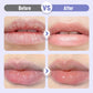 🔥Plumping & Anti-Wrinkle Hydrating Lip Serum - Last Day Buy 1 Get 1 Free🎁