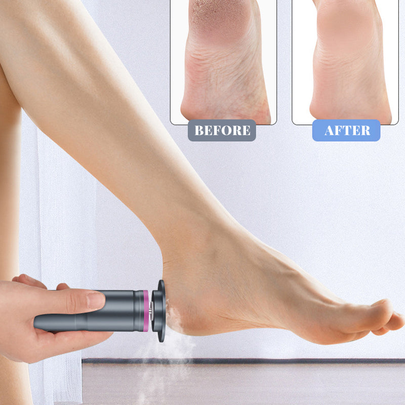 Professional Electric Callus Remover & Nail File Kit