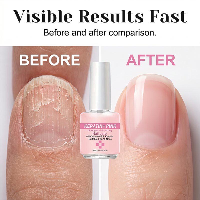 💅 2026 Sale — Over 67,000 Sold!✨ ✨Buy 1 Get 1 Free✨Keratin Nail Strengthener & Moisturizer – Repair & Glossy Finish 🌟